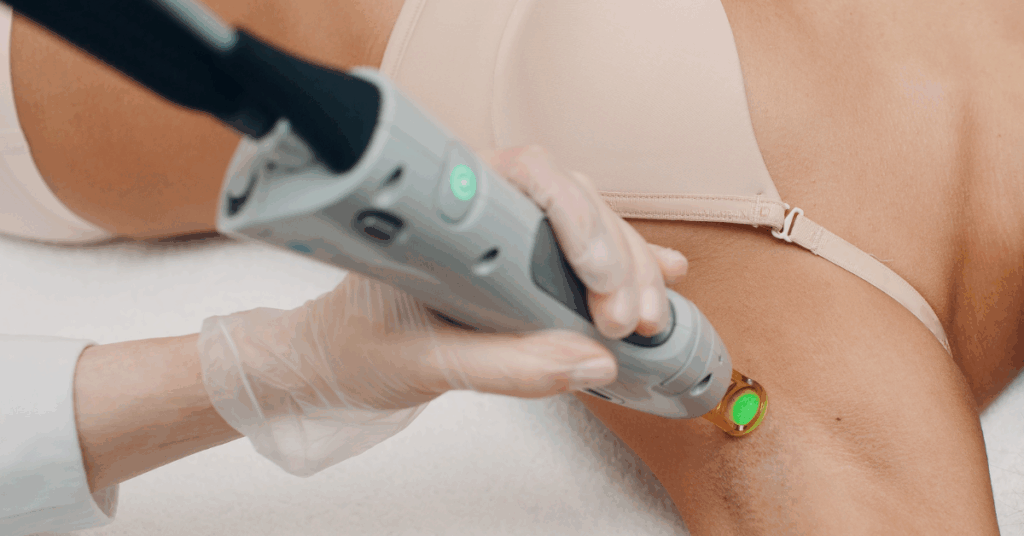 Ofte-stilte-spørsmål-om-hårfjerning-med-laser